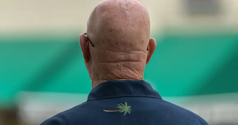 tədqiqatcilar-kecəlliyə-carəni-min-illik-bitkidə-tapiblar.-sac-kok-huceyrələrinin-olumunun-qarsisini-alir